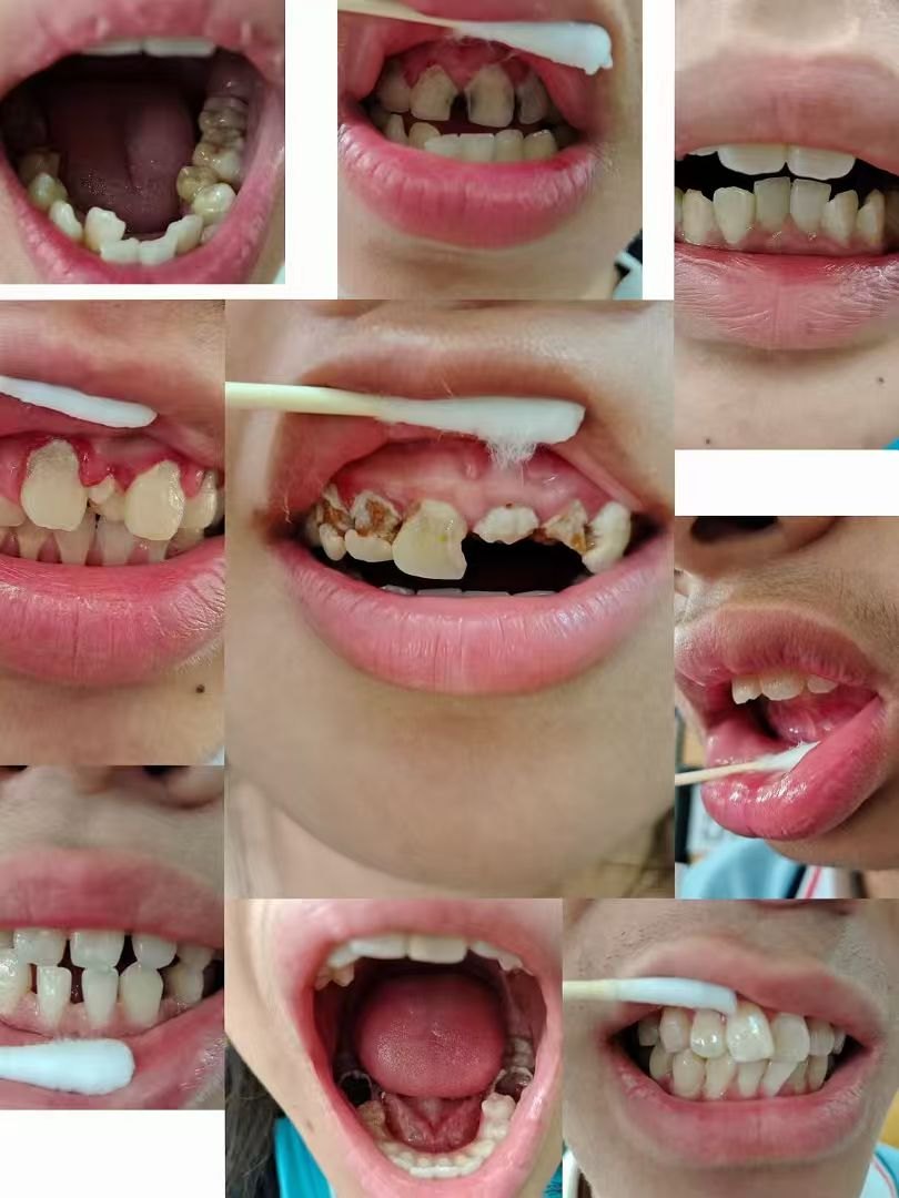 口内档案